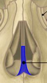 <p>What is the name of this bone in the skull?</p>