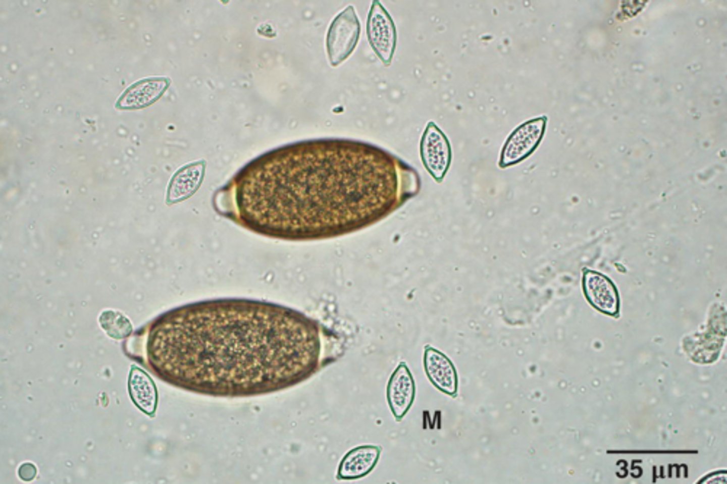 <p>What is the larger parasite if it is from a cat</p>