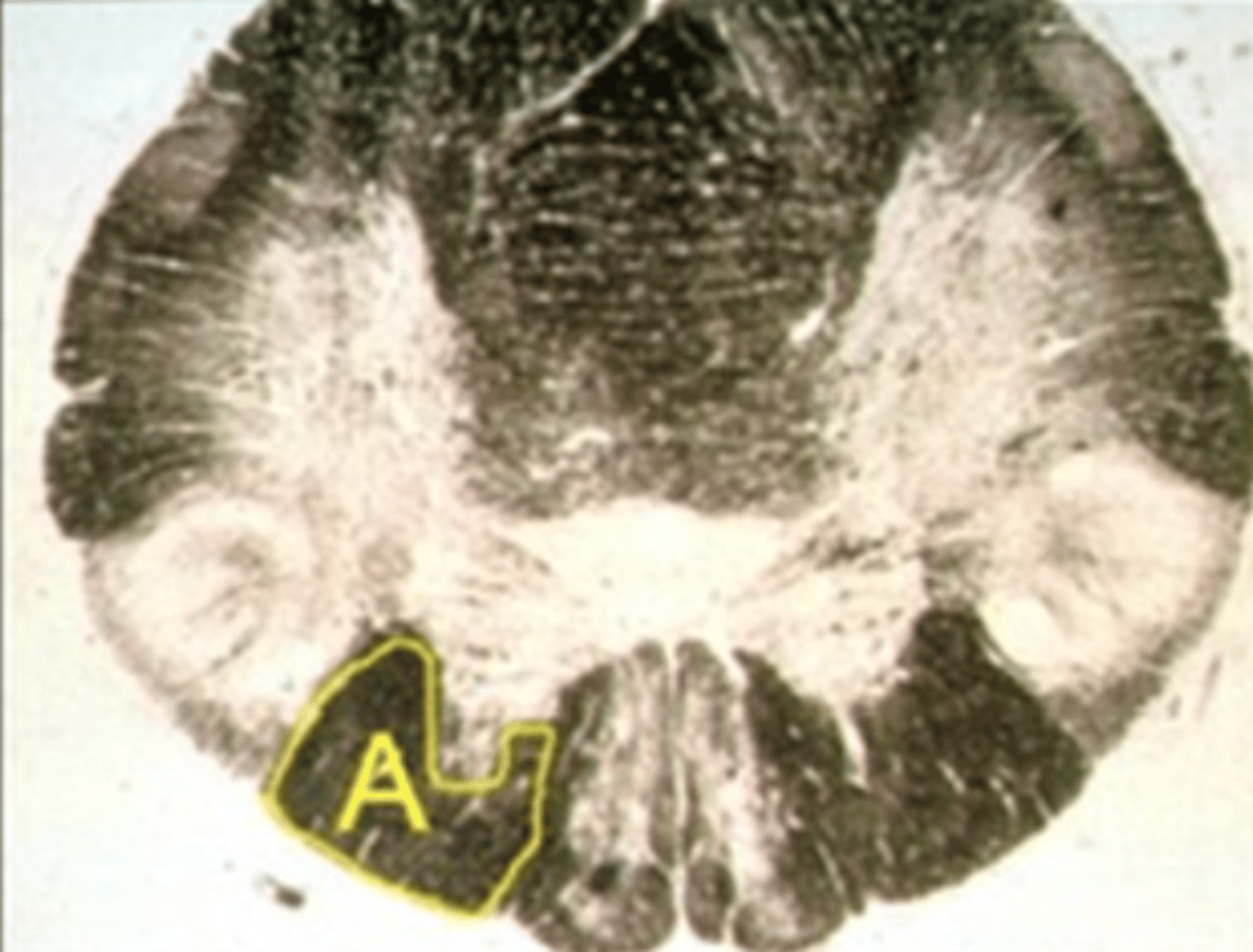 <p>Identify the structure indicated by the outline and letter "A."</p>