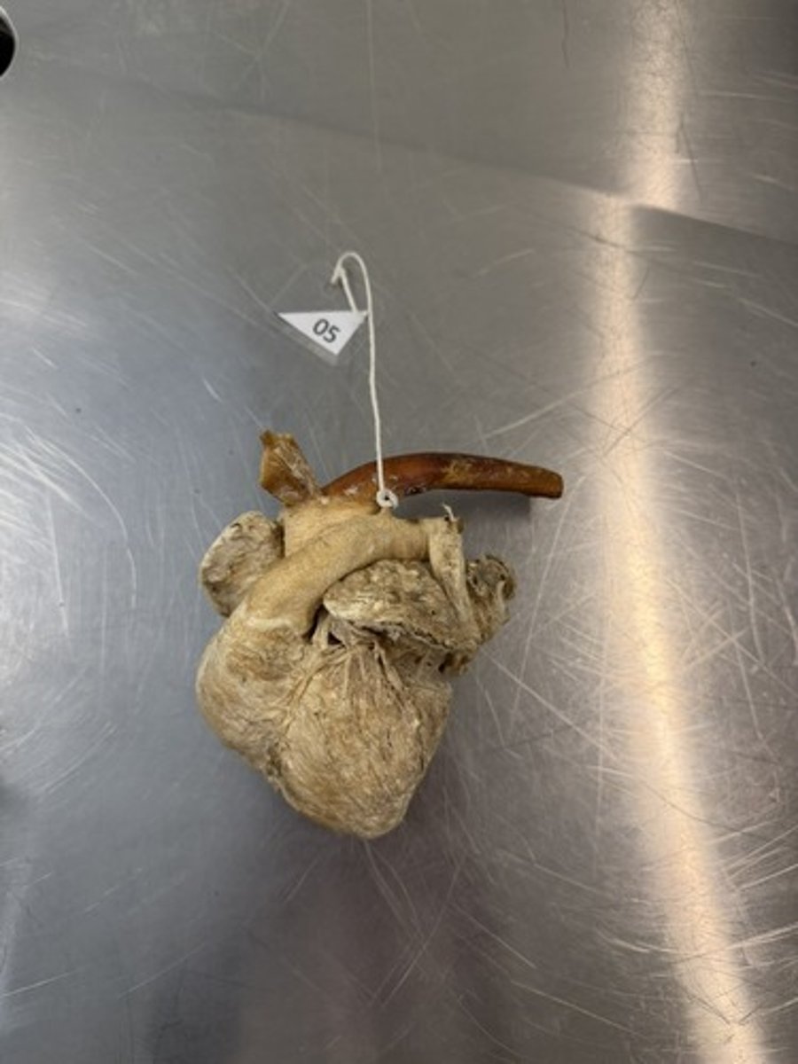 <p>A. ID the structure encircled by the string.</p><p>B. Name another fetal passageway between chambers of the heart.</p>