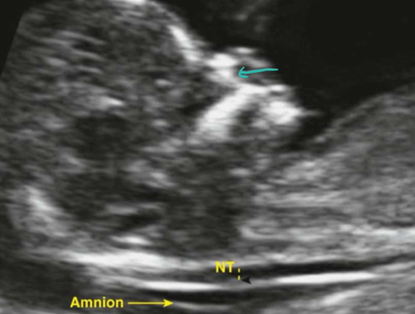 <p>What is the teal arrow pointing to</p>