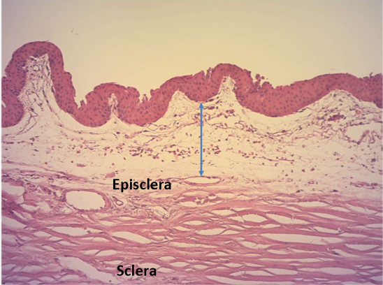 <ul><li><p>Fibrovascular matrix</p></li><li><p>looser matrix in bulbar conj vs palpebral conj</p></li><li><p>attaches to underlying tenons capsule</p></li></ul><p>Contains: Nerves, Blood vessels, lymphatics</p><p></p>