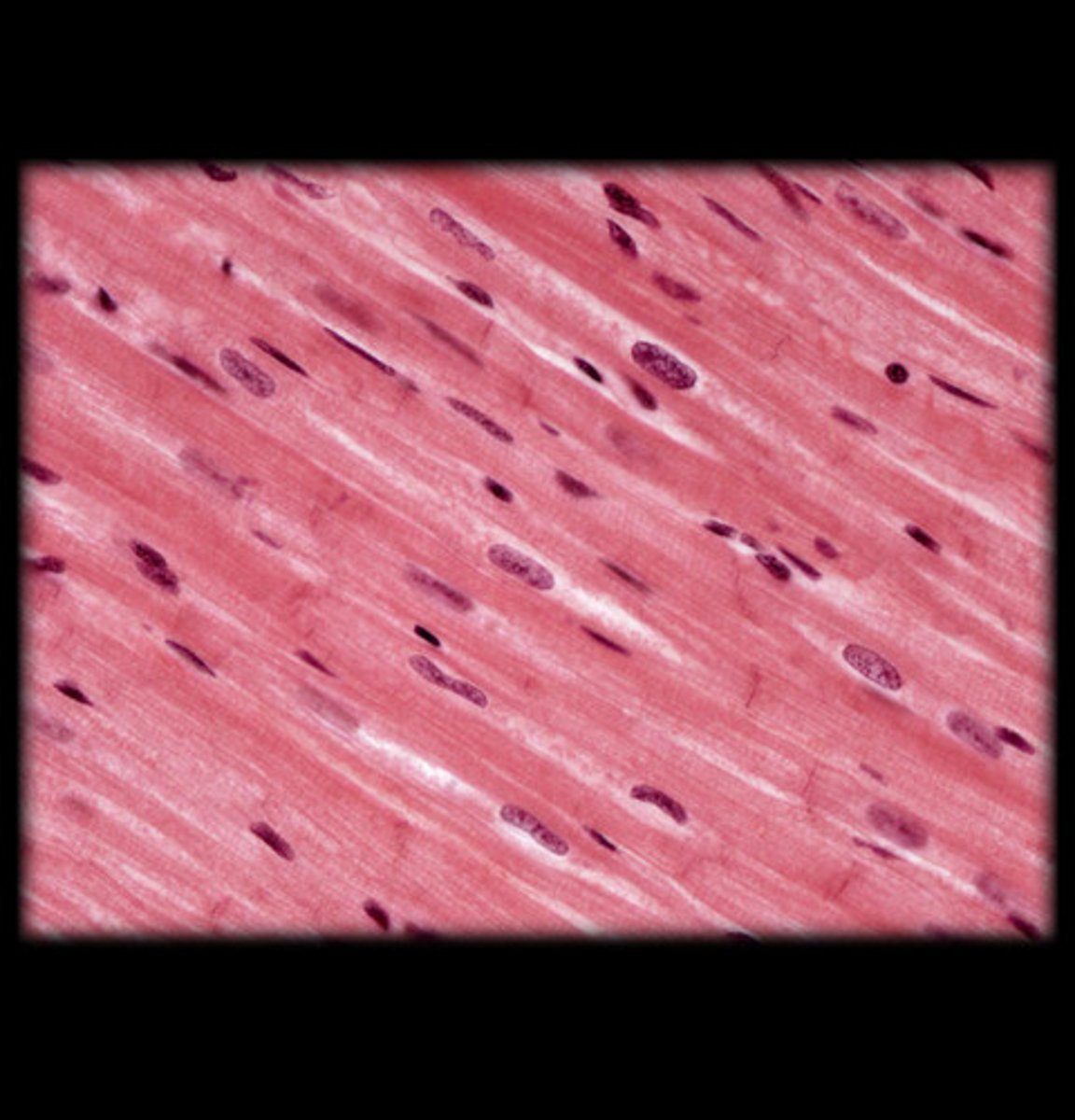 <p>- Striated, involuntary muscle with branching fibers.</p><p>- Cells have a single, centrally located nucleus and are connected by intercalated discs (visible as dark lines).</p><p>- Appears with striations, but fibers are branched and connected at intercalated discs, giving a "net-like" appearance under the microscope.</p><p>- Found in the heart.</p>