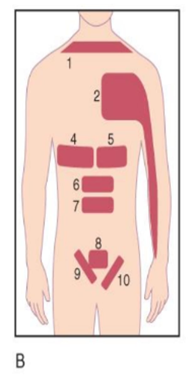 <p>Across right side of upper abdomen (4 in image).</p>