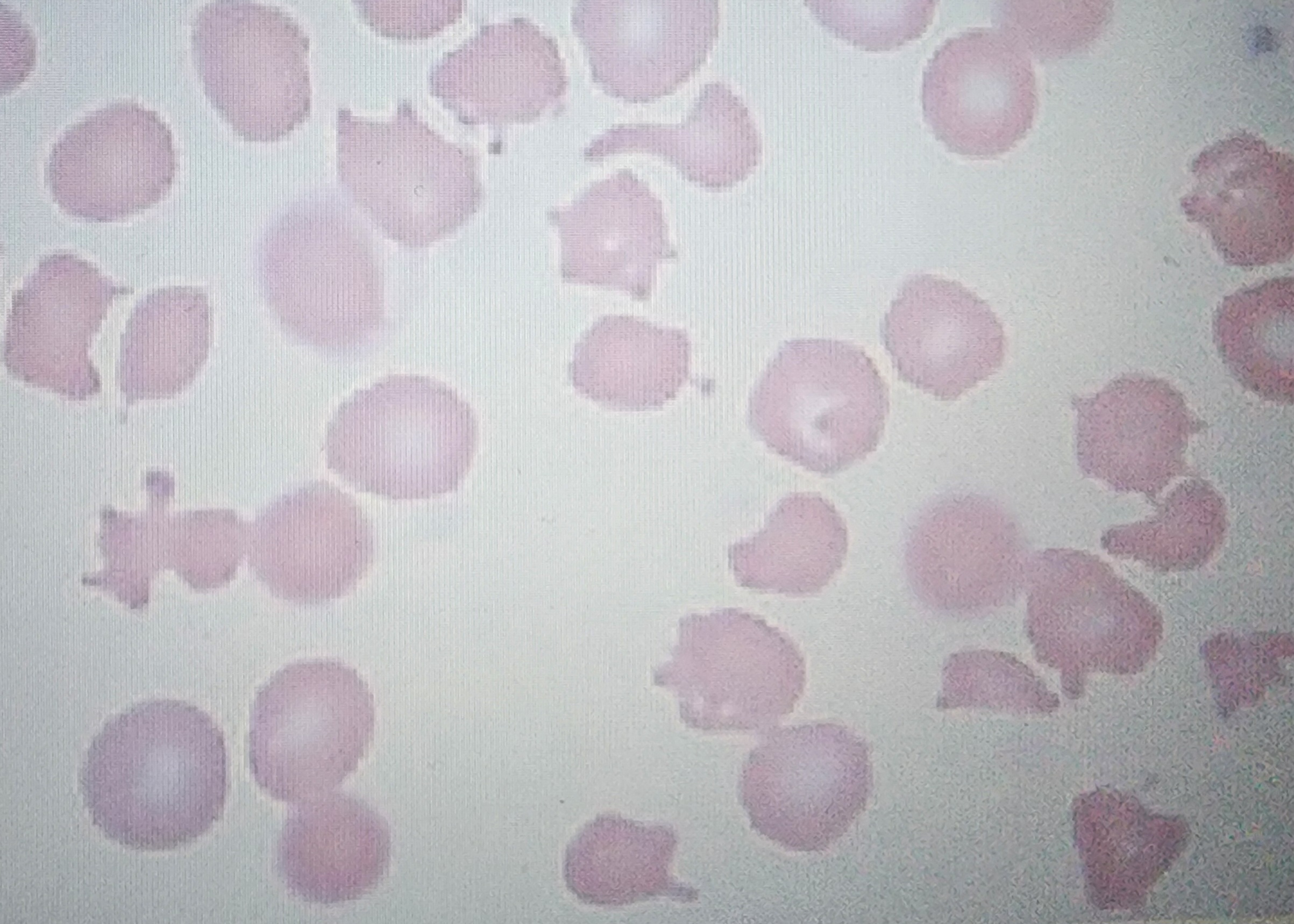 <p>generic term for any abnormalities</p>