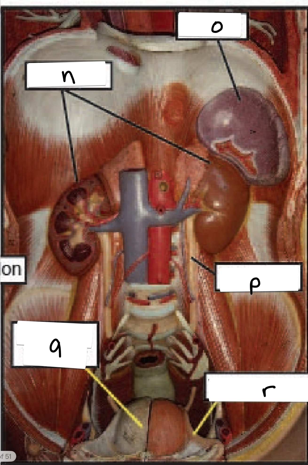 <p>what is labeled r on this anterior view of the torso?</p>