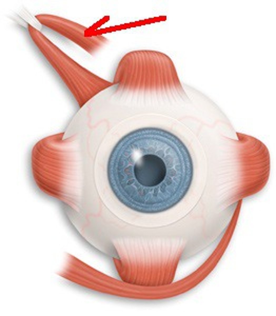 <p>primary: intorsion<br>secondary: depression abduction<br>Cranial Nerve 4</p>