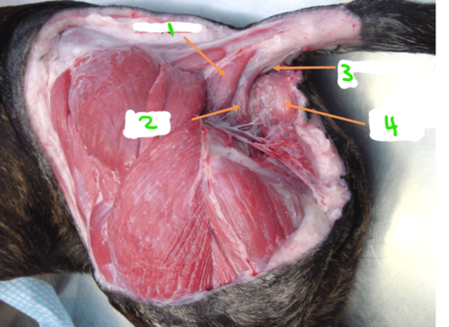 <p>Male perineal anatomy</p>