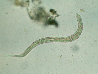 <p>in human feces</p><p>Dermatitis, coughing, lung hemorrhage, capillary hemorrhage, rarely kills</p><p>worldwide</p>