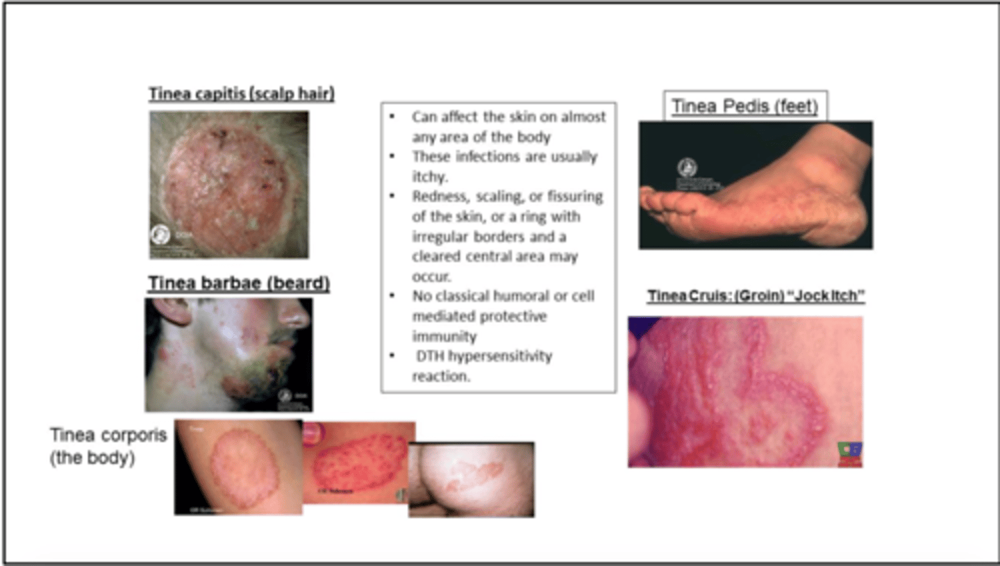 <p>diseases caused by fungi</p>