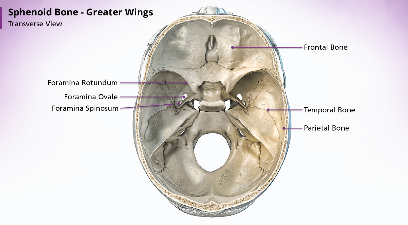 <p>The paired greater wings of the sphenoid bone arise posteriorly from the lateral borders of the body. They extend upwards, laterally and backward. Within the greater wings are the foramina rotundum, foramina ovale, and foramina</p>