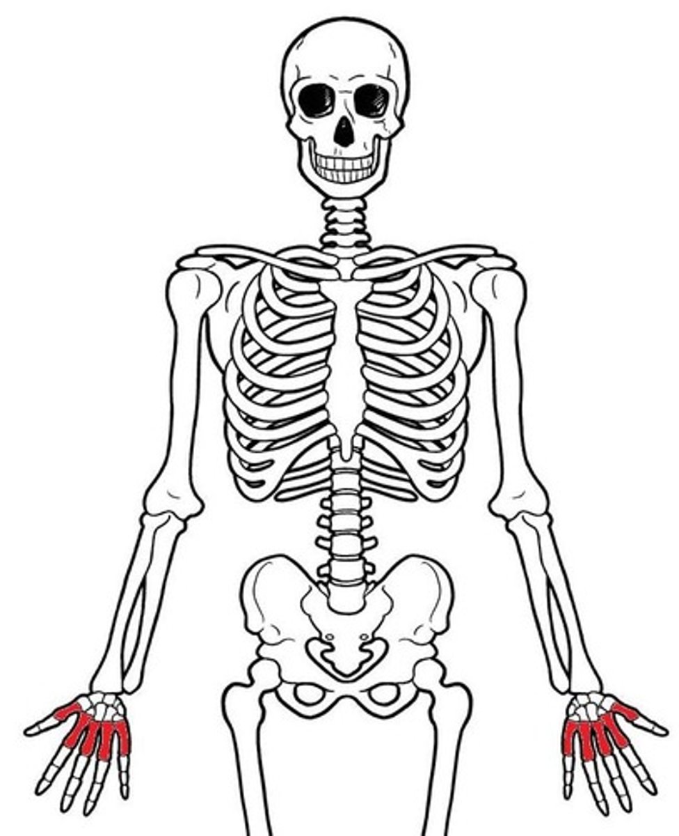 <p>ID red bones</p>