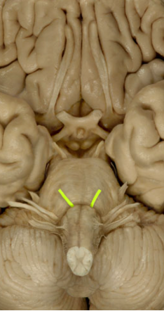 <ul><li><p>Adduct/ Abduct eye </p></li></ul><p></p>