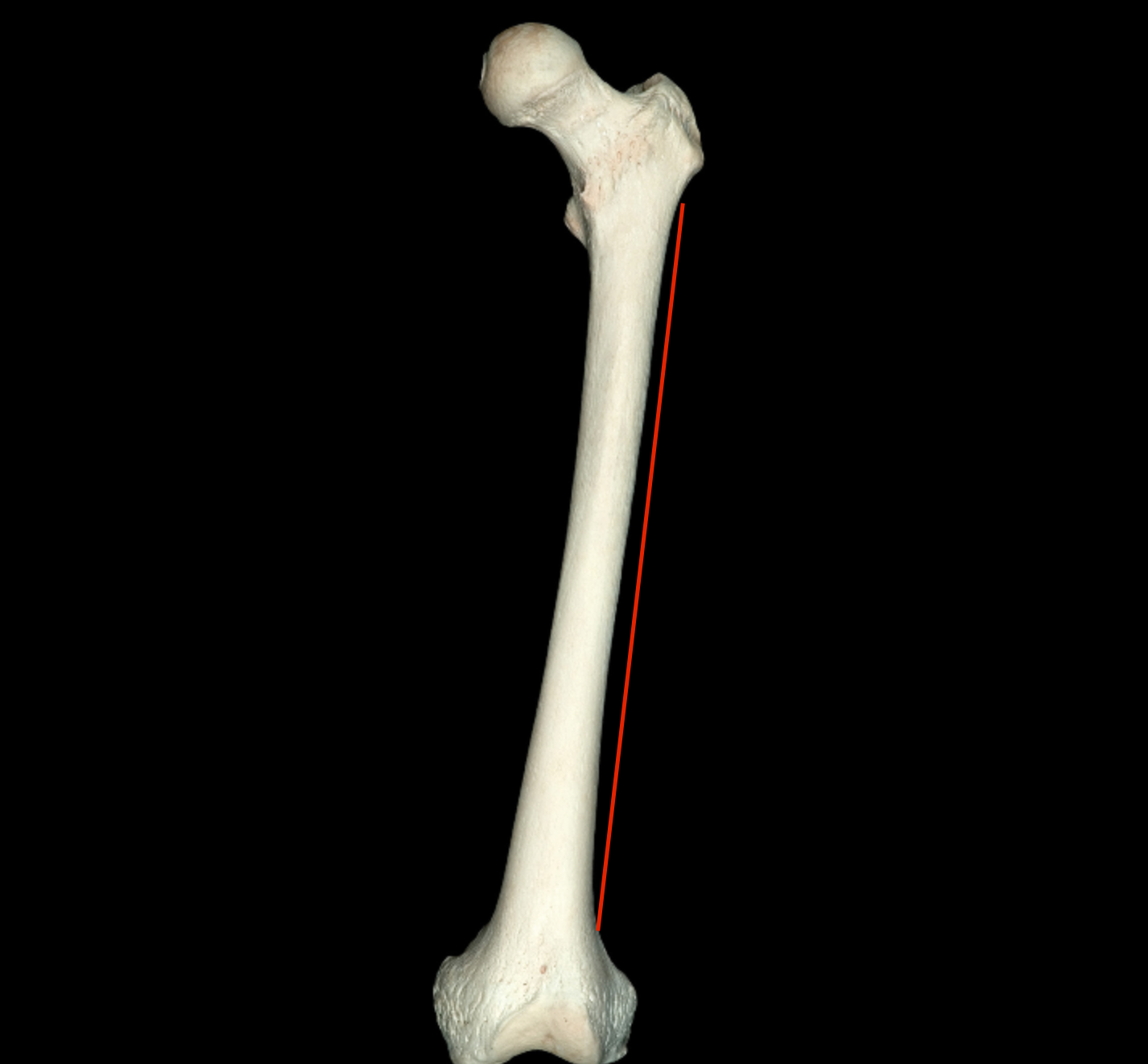 <p>border above lateral condyle of femur</p>