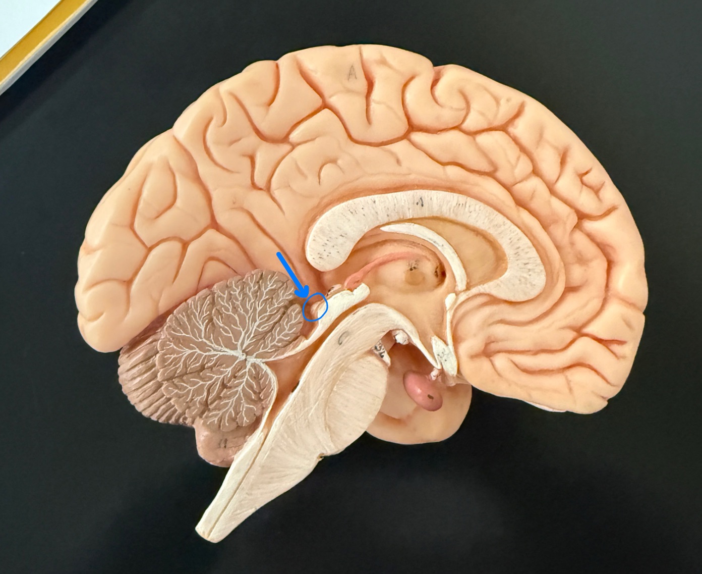 <p>What is outlined in blue on the brain model?</p>