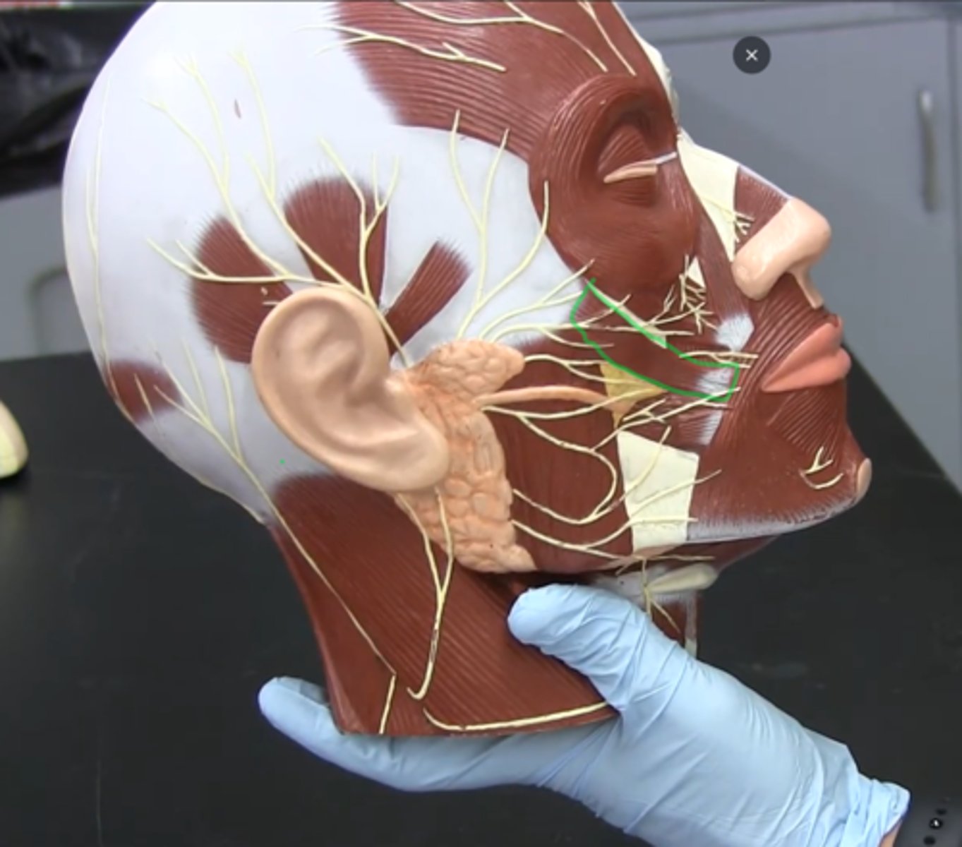 <p>(Top) a muscle of facial expression. It originates from zygomatic bone and continues with orbicularis oculi on the lateral face of the levator labii superioris and then inserts into the outer part of the upper lip.</p>