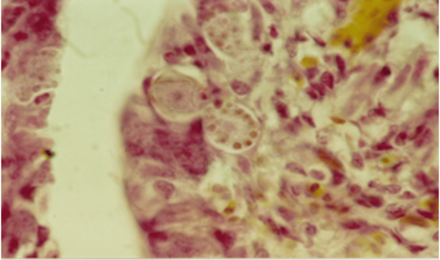 <p>Slide from a dead chicken - What parasite and life stage is this?</p>