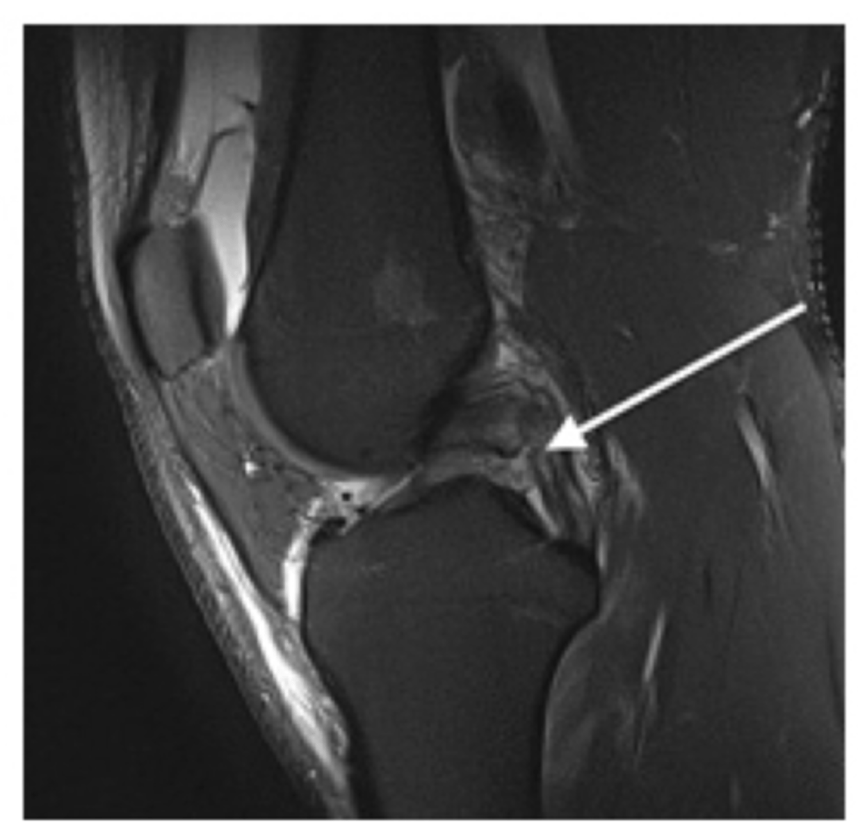 <p>Define the pathology. How do you know?</p>