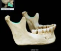 <p>between mandibular condyle and coronoid processes; broad notch along superior border of mandibular ramus; aka mandibular incisure</p>
