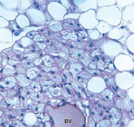 <p>1. Specimen?<br>2. Describe and compare to the other type.</p>