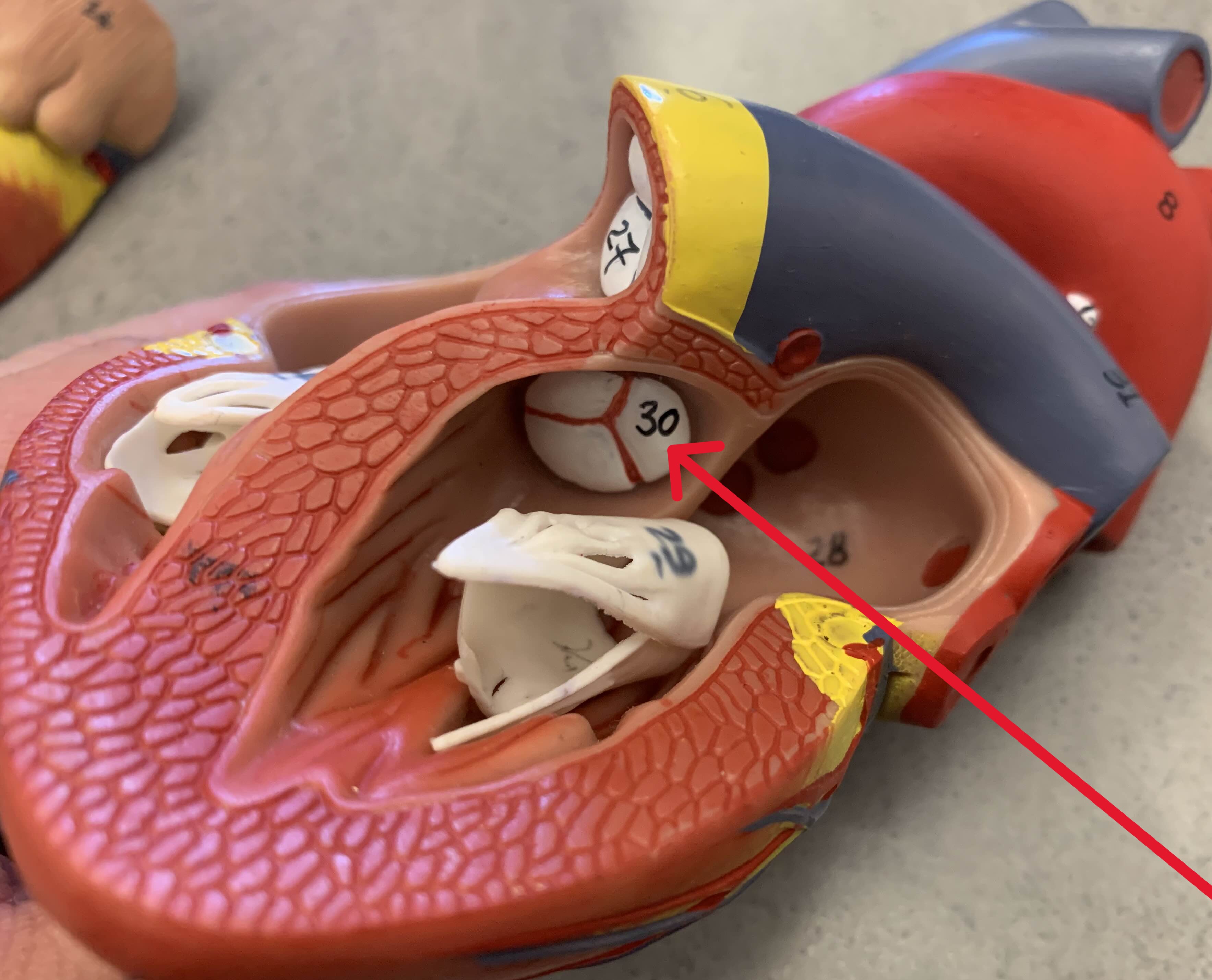 <p>Which valve of heart:</p><ul><li><p>Between <u>left</u> ventricle and aorta</p></li></ul><p></p>
