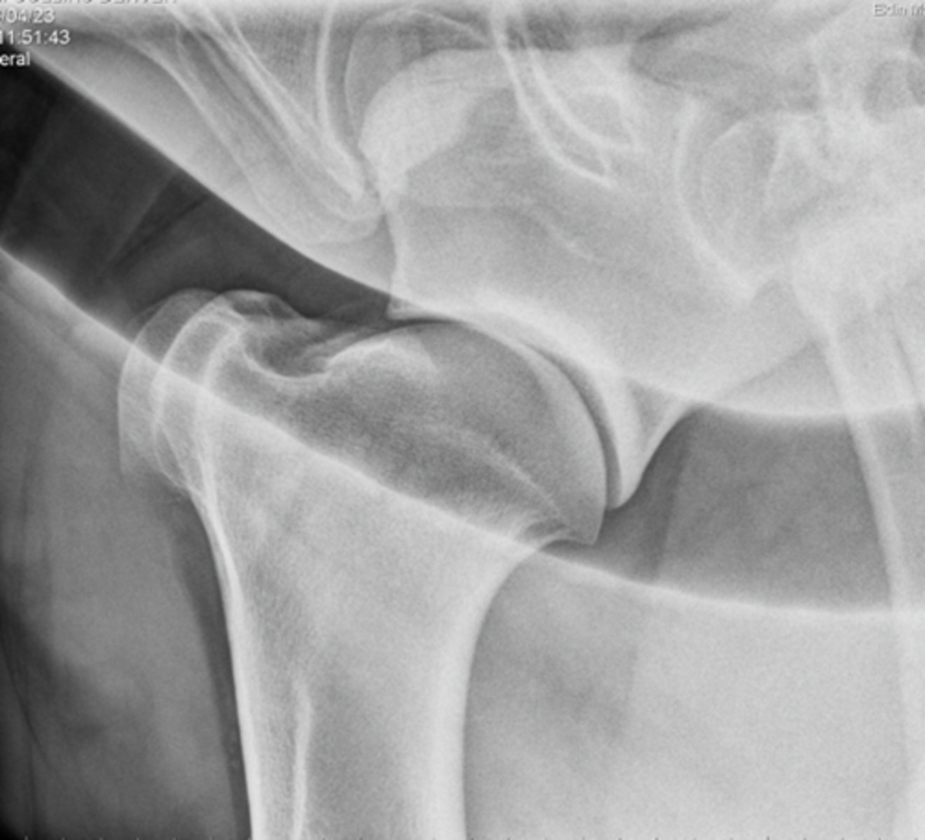 <p>What structures are highlighted by a mediolateral shoulder rad?</p>