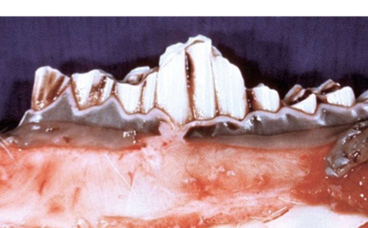 <p>What is the pathology?</p>