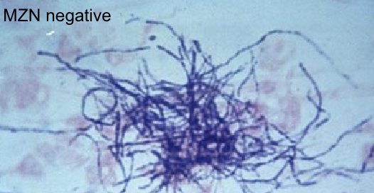 <p>MZN negative </p>