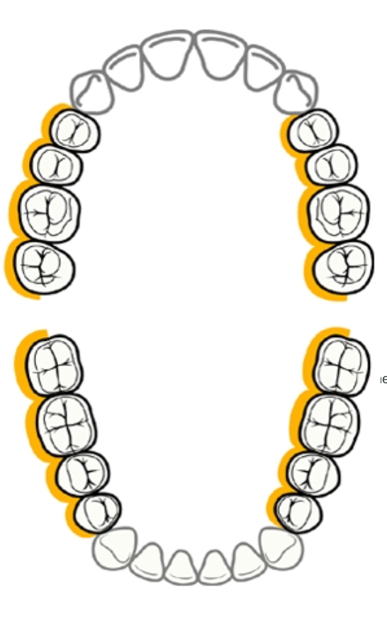 <p><strong>What posterior aspect is this to the clinician, and what clock position?</strong></p>