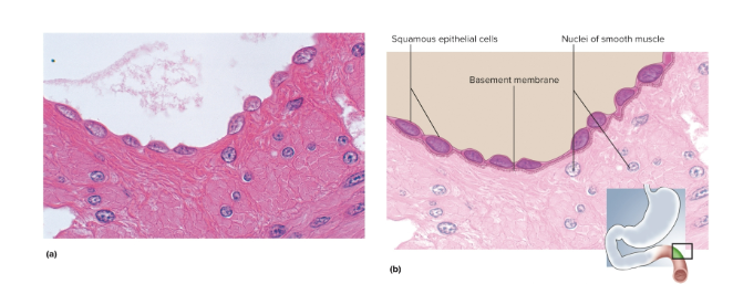 <p>Simple squamous epithelium</p>