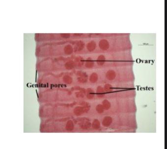 <p>what is this ?</p><p>phylum and class ?</p><p>two special characters ? (describe the male and female systems )</p><p></p>