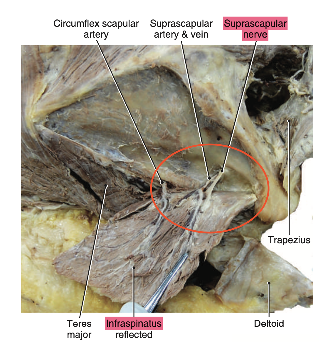 <p>Suprascapular nerve</p>