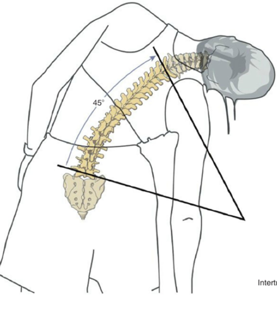<p>Thoracic Region:</p><p>1. In thoracolumbar right lateral flexion, the facets are doing what?</p><p>2. In thoracolumbar left lateral flexion, the facets are doing what?</p>