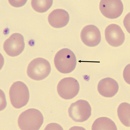 <p>What is the inclusion in this erythrocyte?</p>