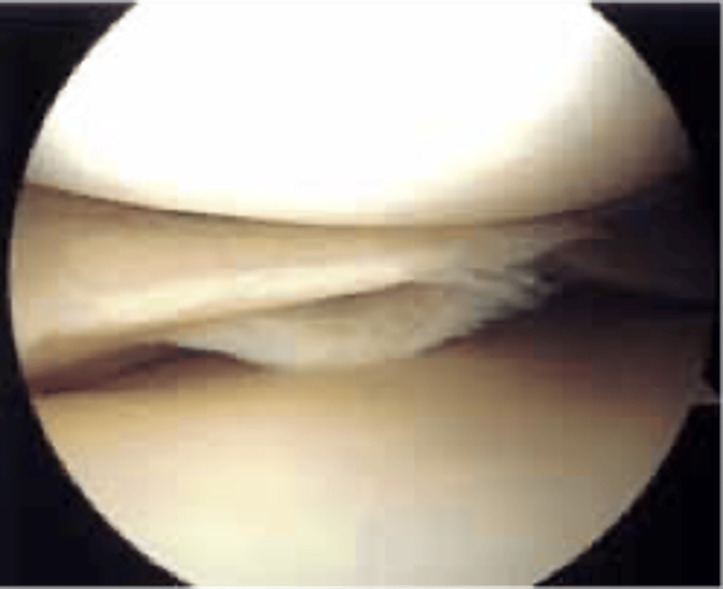 <p>young athletic people or men or women over the age of 55</p>