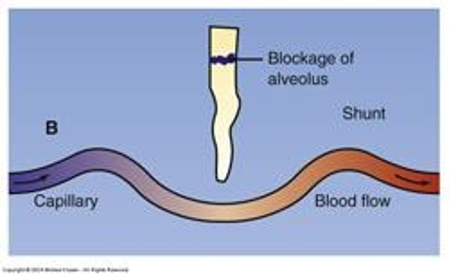 <p>The relationship between ventilation and perfusion in the lungs.</p>