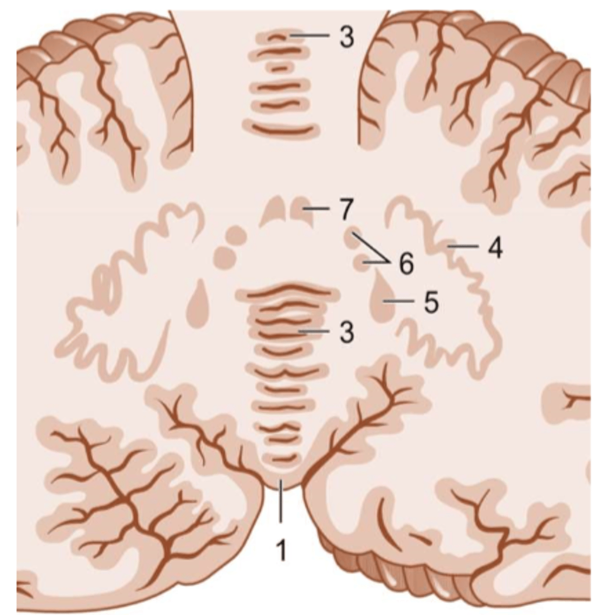 <p>Nucleus dentatus</p><p>Nucleus emboliformis</p><p>Nucleus globosus</p><p>Nucleus fastigii</p>