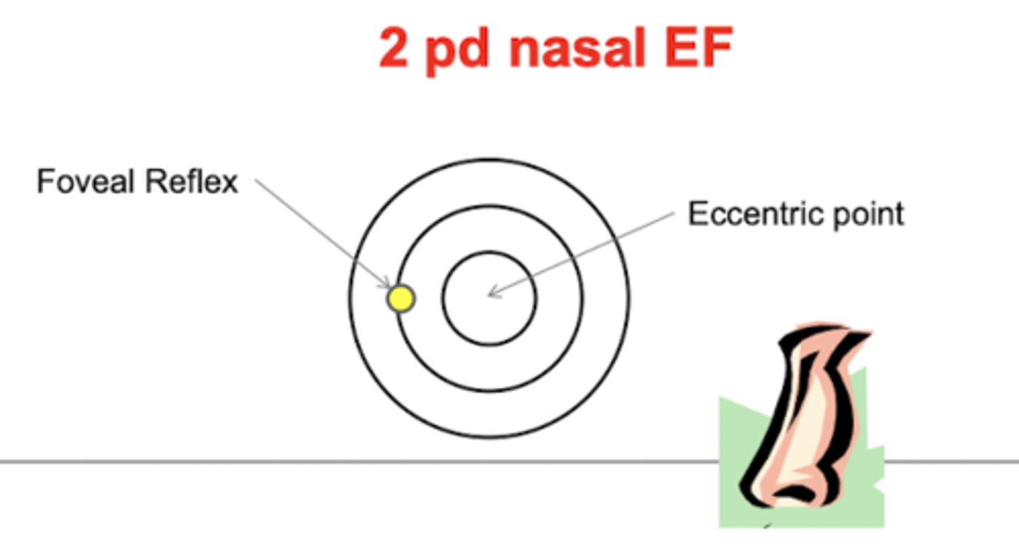 <p>if fixation is central or eccentric → if eccentric determine the direction and magnitude of eccentric fixation</p>