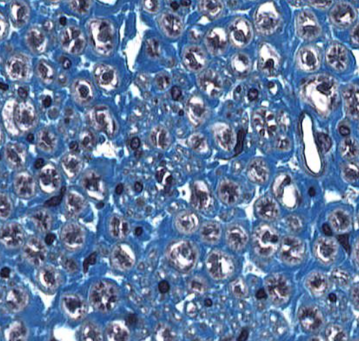 <p>(gray/dark blue structure)</p>