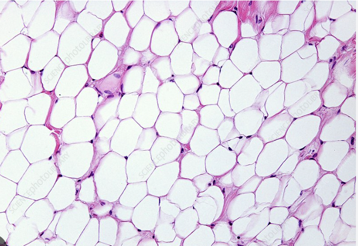 <p>Type of Tissue?</p>