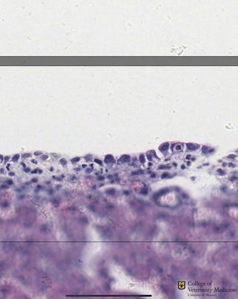 <p>What tissue type is shown?</p>