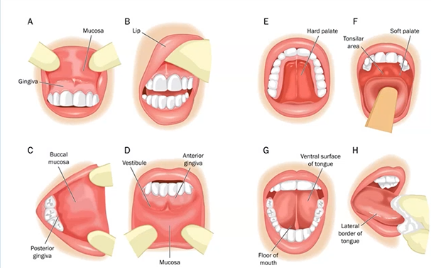 <ol><li><p>Oral Mucosa</p></li><li><p>Tongue</p></li><li><p>Floor of mouth</p></li><li><p>Salivary gland ducts</p></li><li><p>Frenum attachments</p></li><li><p>Gingivae</p></li><li><p>Tonsils and oropharynx</p></li><li><p>Teeth</p></li><li><p>Occlusion</p></li><li><p>Prosthesis</p></li></ol><p>start by looking at lips - mucosa buccal - tongue - ventral surface last, back of the throat and hard palate </p>