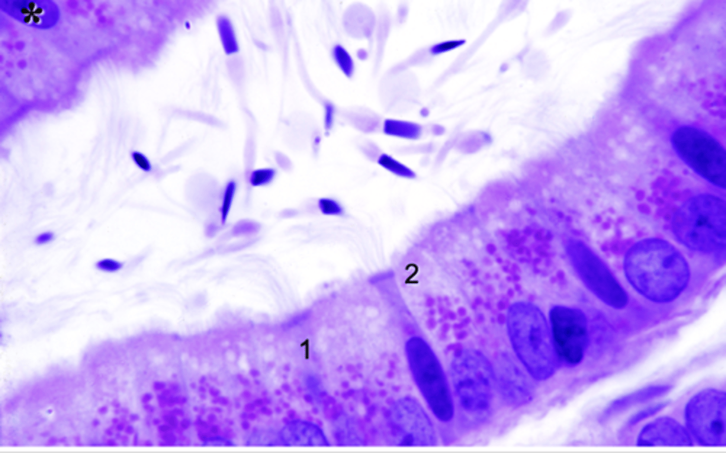 <p>What is 1?</p>