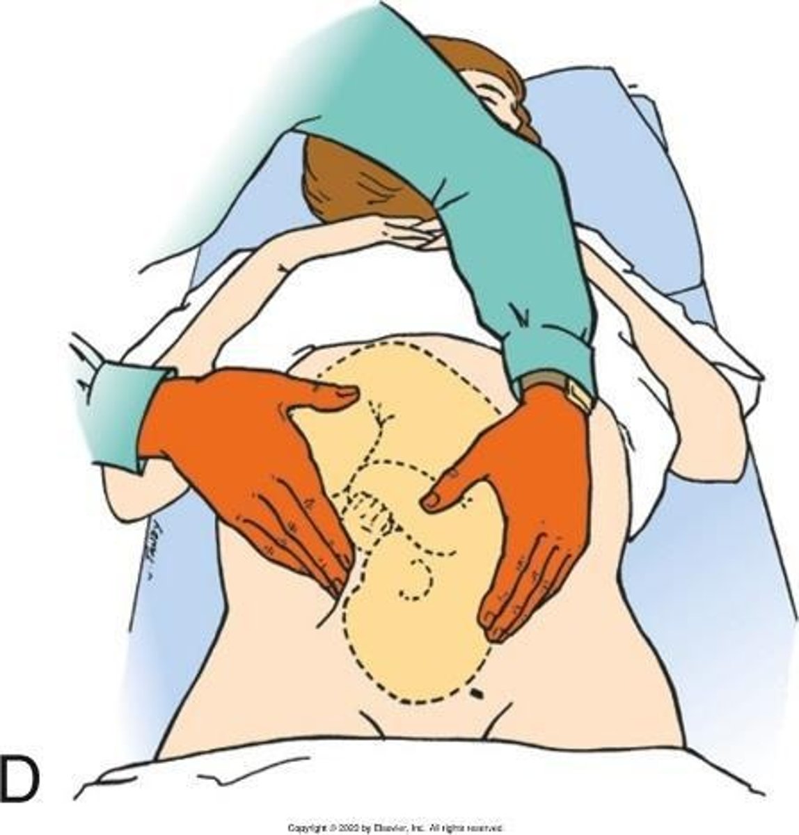 <p>To assess fetal position and presentation through abdominal palpation.</p>