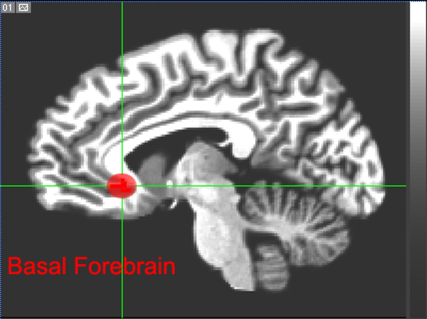 <p>What is the function of the basal forebrain in the Circadian Biologic Clock?</p>