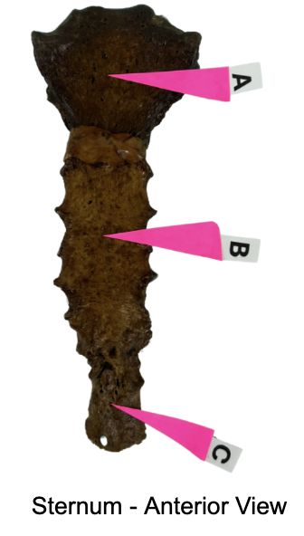 <p>Identify the “body of sternum” (aka “gladiolus”)</p>