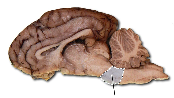 <p>Name the part of the brain that is highlighted.</p>