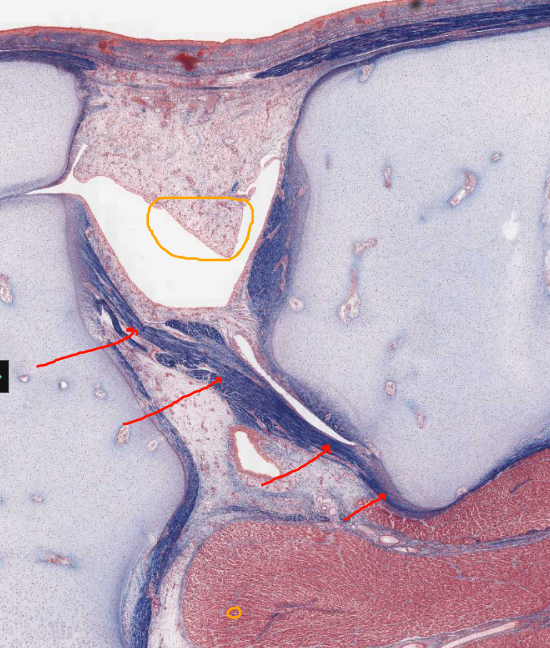<ol start="11"><li><p>Which best fits this structure<br>A. Cruciate Ligament</p><p>B. Fibular Ligament</p><p>C. Popliteal Ligament</p><p>D. Tibial Ligament</p></li></ol><p></p>