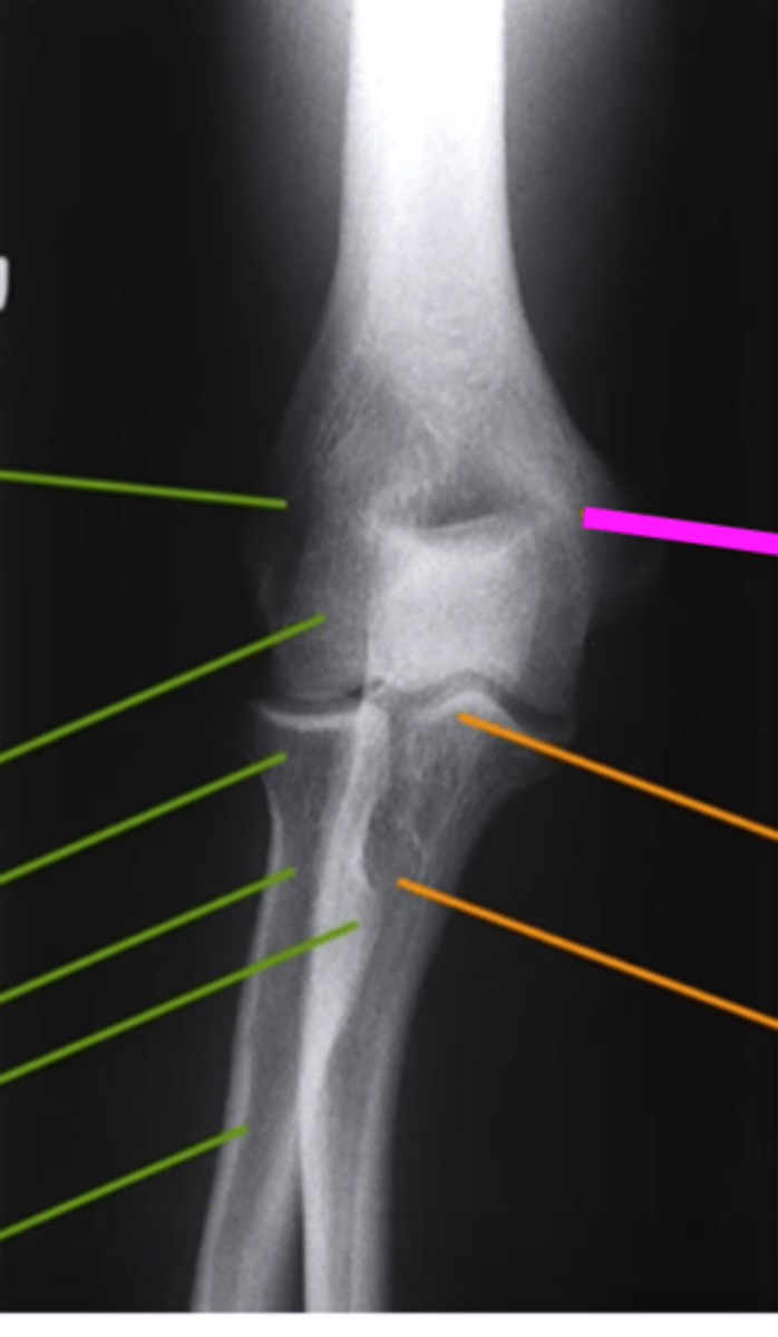 <p>what does the pink line point to?</p>