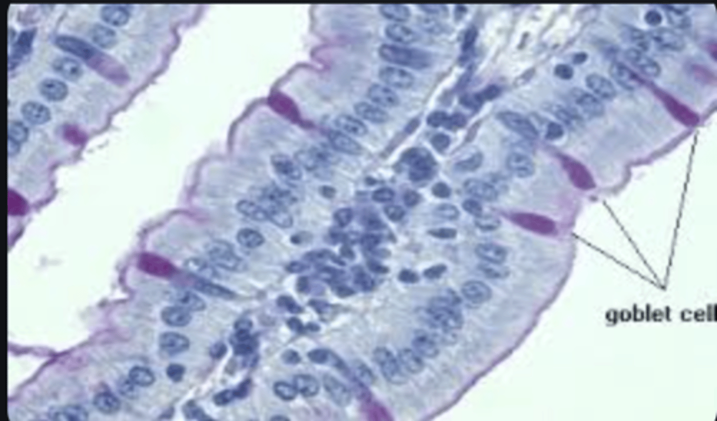 <p>Goblet cell.</p>